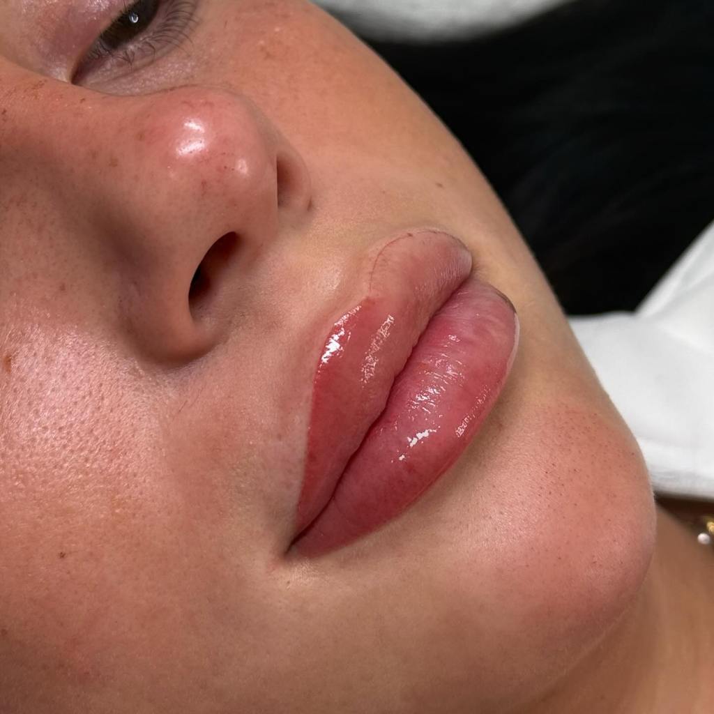 Woman after recieving lip blushing